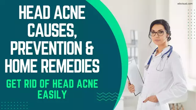 head acne causes, prevention and home remedies